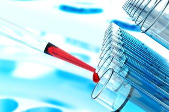 NLS Pharmaceutics and Kadimastem Announce Completion of Material Conditions Precedent for Merger Transaction and Delisting Date of Kadimastem’s Shares